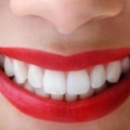 Cara Alami Agar Gigi Selalu Sehat Untuk Senyum Cantik