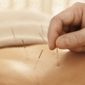 Dapatkah Akupunktur Menurunkan Berat Badan? Inilah yang Harus Anda Ketahui