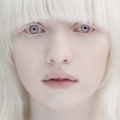 Seputar Anak Albino dan Mitosnya