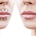 3 Tips Rias ala Makeup-Artist untuk Mempertebal Bibir Tipis