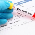 Lima Cara Hindari Kekurangan Vitamin D