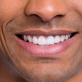 Perawatan Gigi: 5 Obat Rumahan yang Baik untuk Memutihkan Gigi