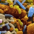Studi, Bakteri Akan Menghentikan Anda Menginginkan Makanan Tertentu