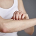 Psoriasis: Apa kondisi kulitnya? Apakah Anda Berisiko?